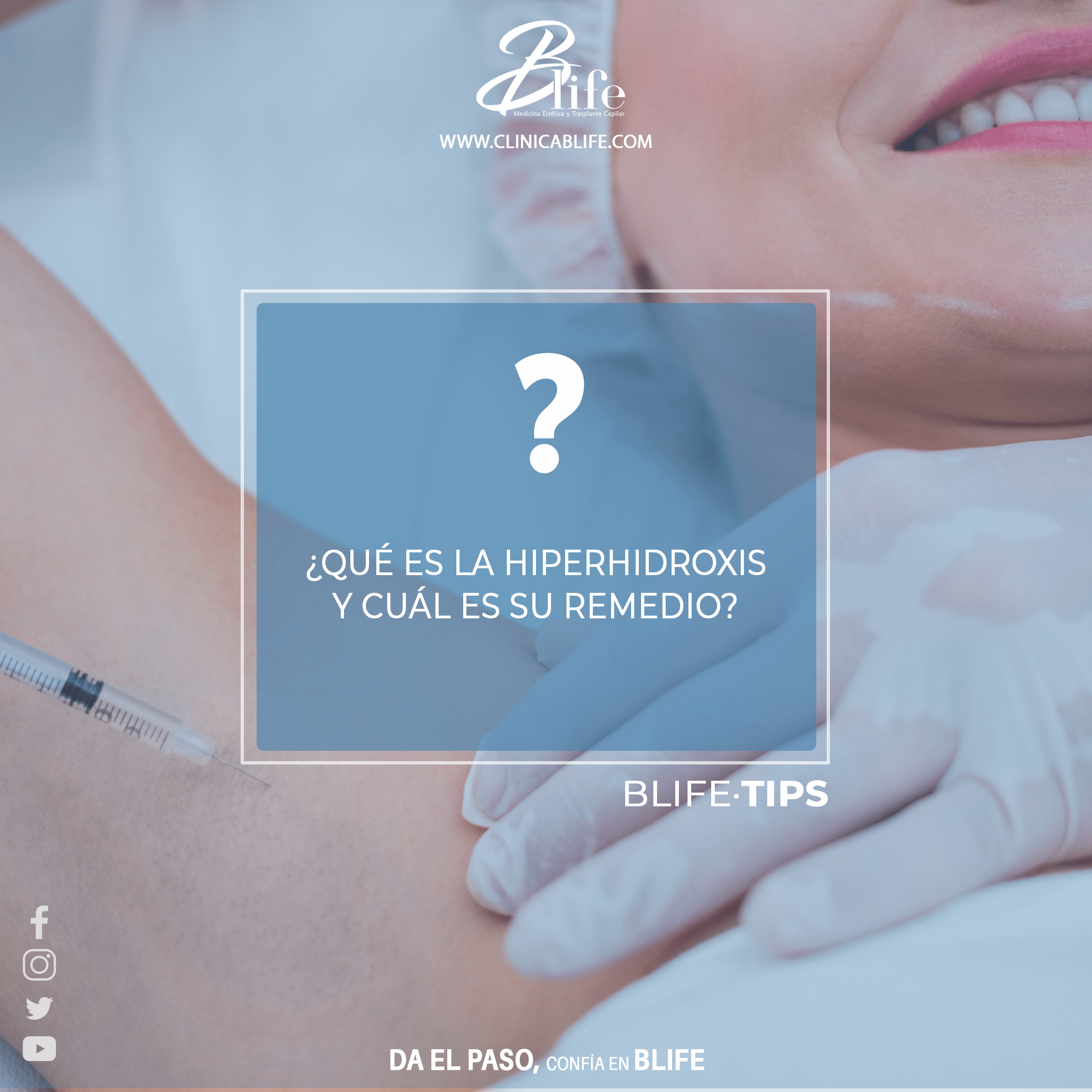 hiperhidrosis en Madrid