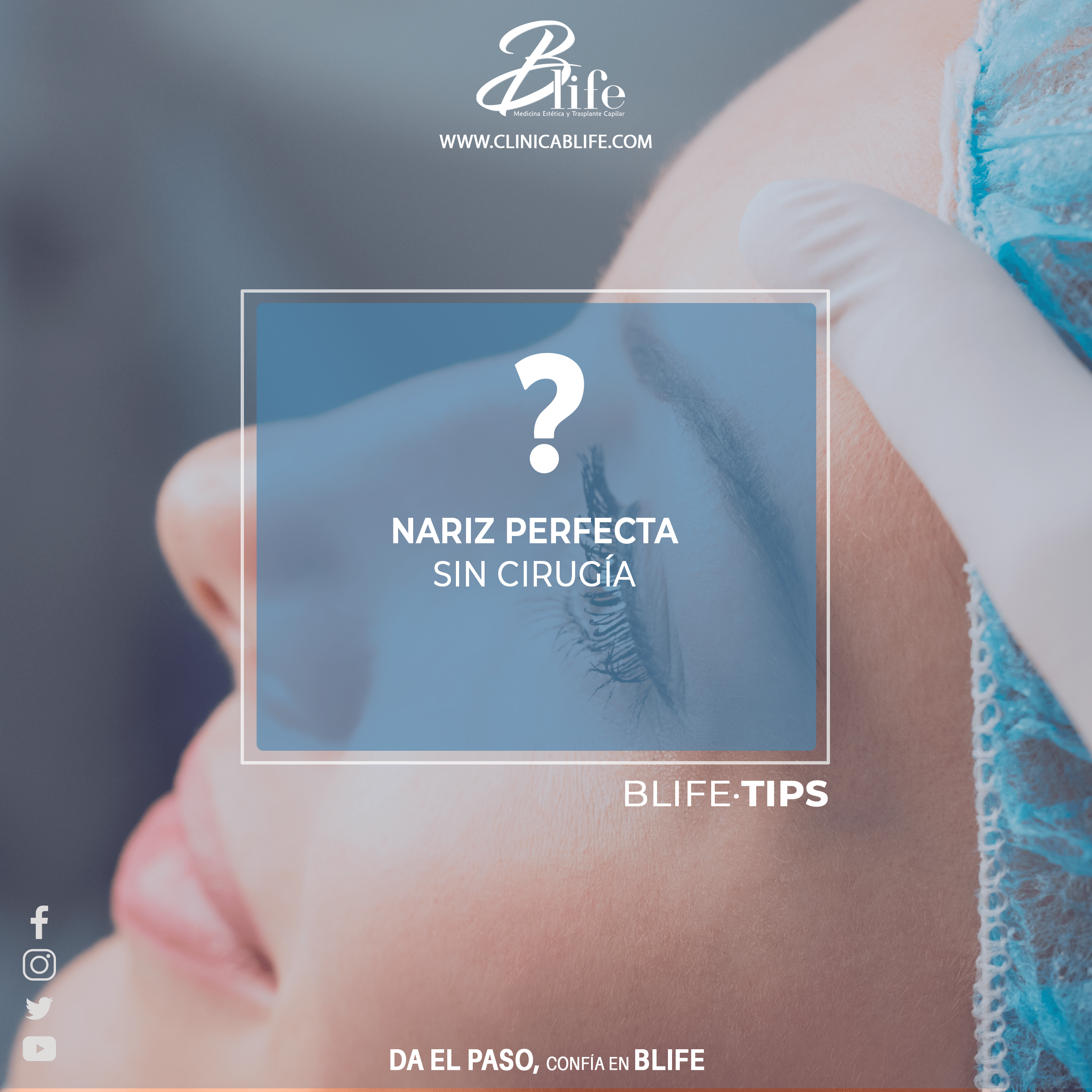 CLINICA-ESTETICA-RINOMODELACION