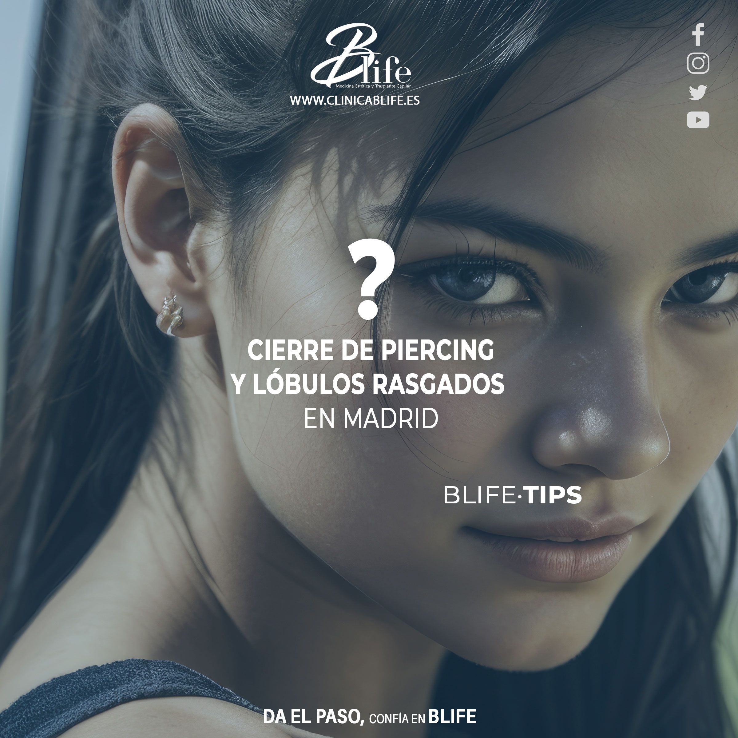 Cirugía Estética para Cierre de Piercings y Lóbulos Rasgados