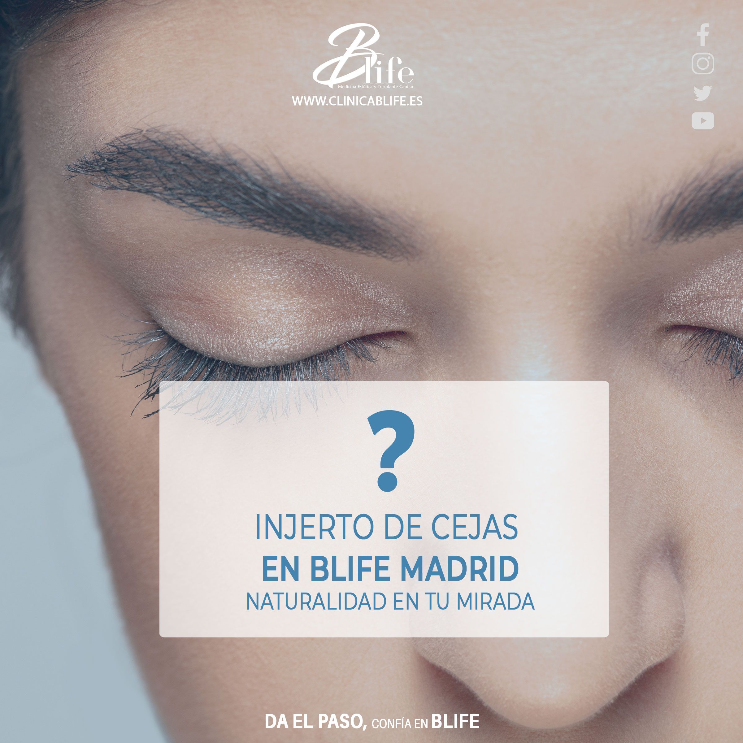 Injerto de Cejas en Blife Madrid