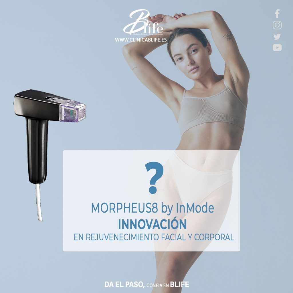 MORPHEUS8-EN-MADRID-BY-INMODE