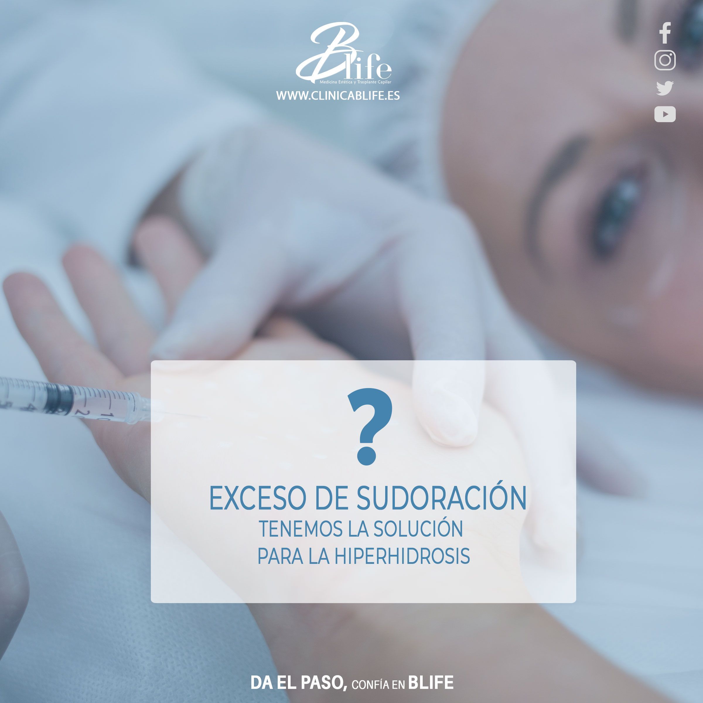 Tratamiento para el exeso de sudoración en axilas, pies y manos
