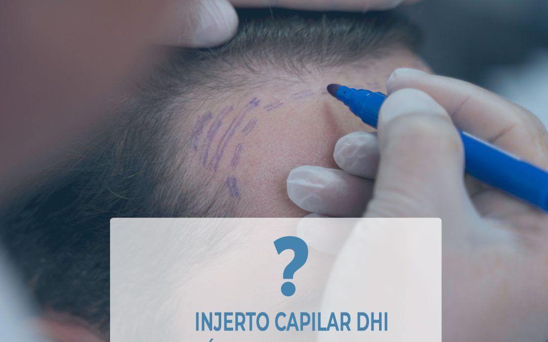 DHI-EN-MADRID