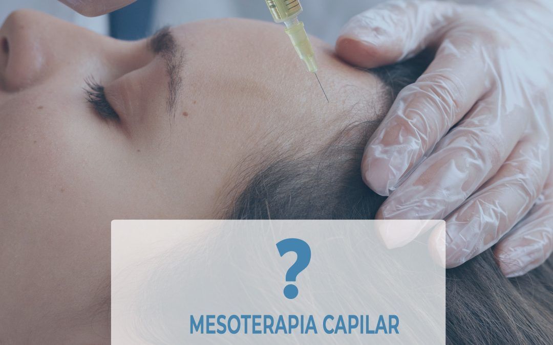 MESOTERAPIA-CAPILAR-MADRID