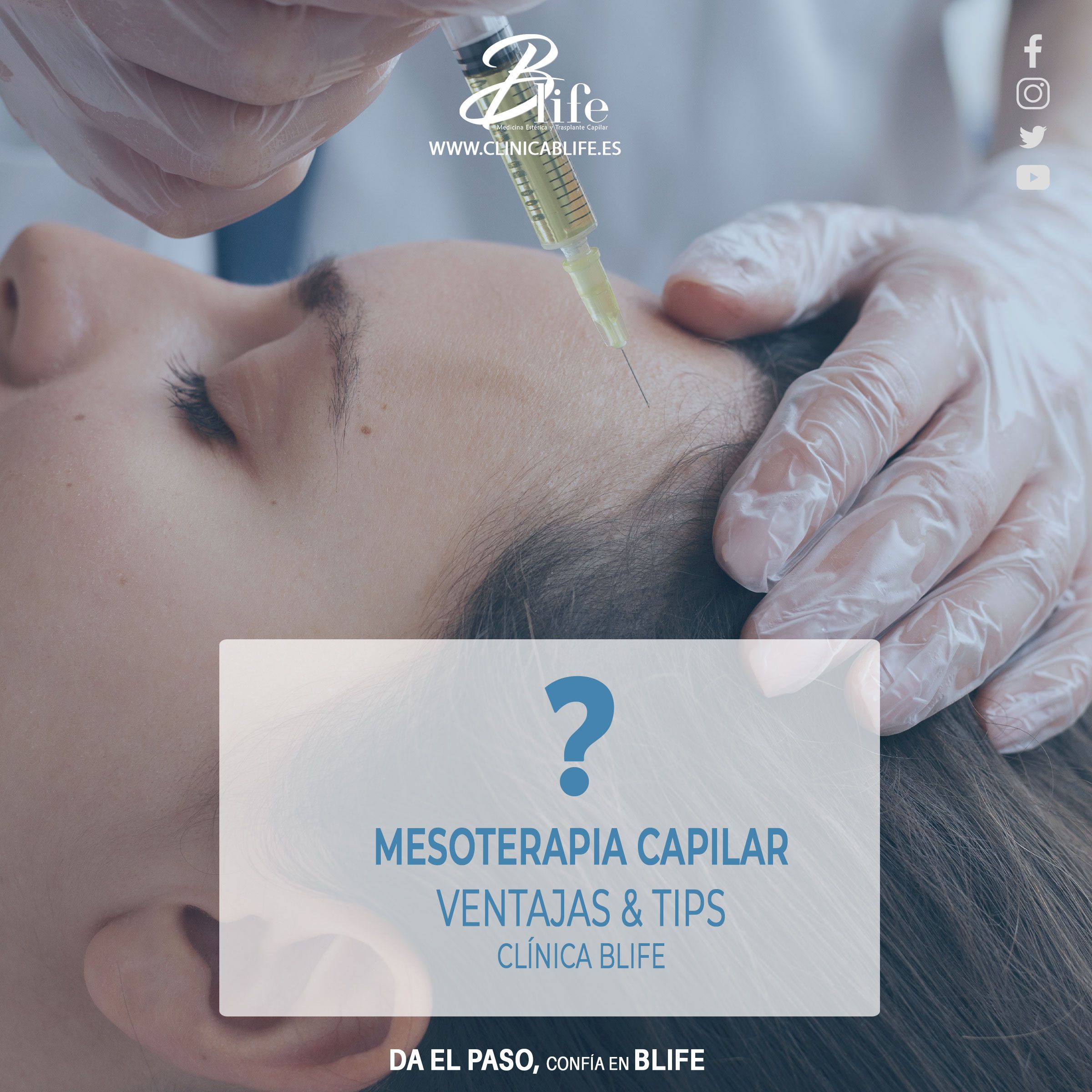 MESOTERAPIA-CAPILAR-MADRID