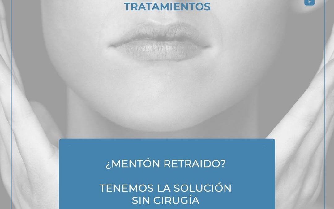 Soluciones para el menton retraido relleno