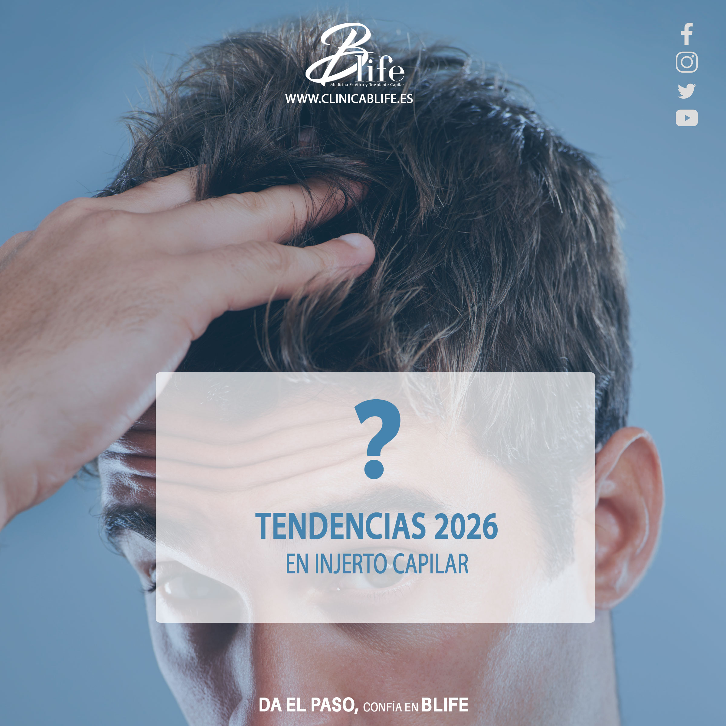 TENDENCIAS-2026-INJERTO-CAPILAR-EN-MADRID